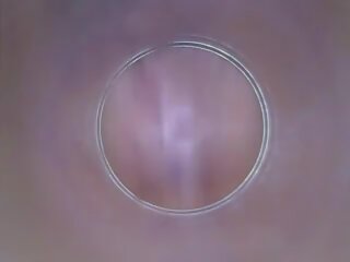Dildocam – Thin Brunette Showing Her intern Vagina Cervix | xHamster